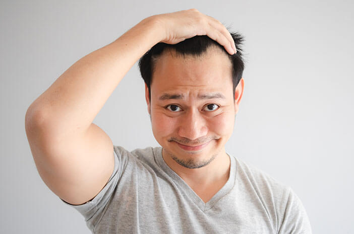 Kelliği Önleyin, İşte Saç Dökülmesini Nasıl Aşabilirsiniz?